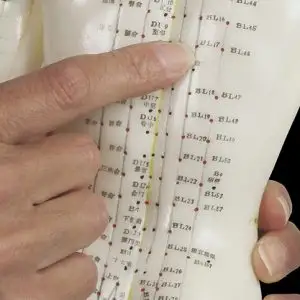 Acupuncture Health Care