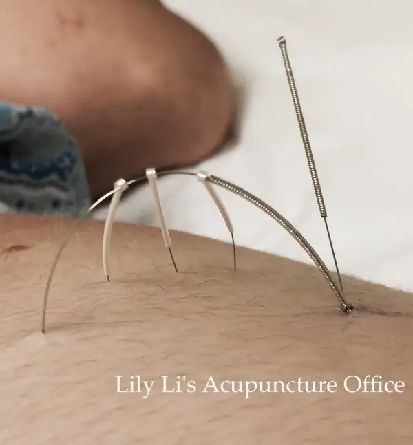 Acupuncture & Oriental Health Care