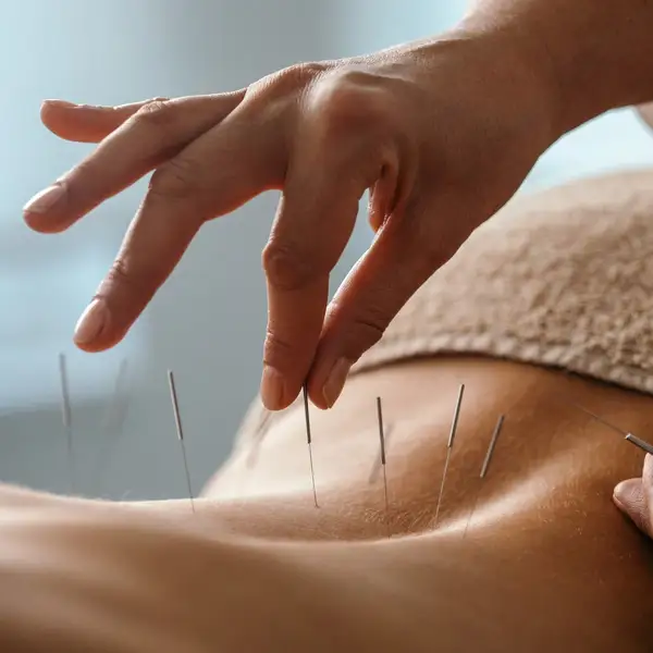 Body Mind Wellness Acupuncture PC