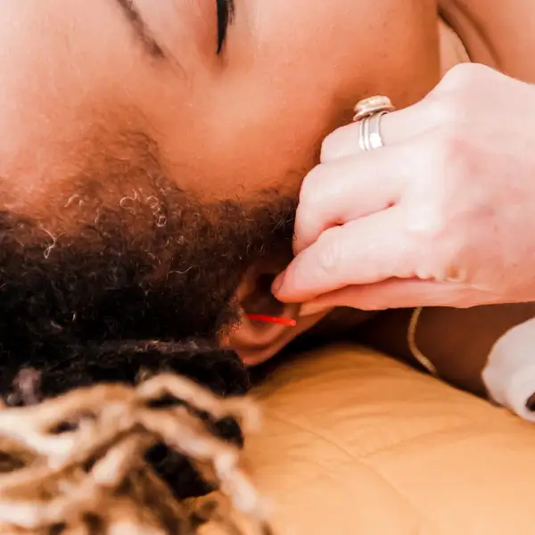 PMA ACUPUNCTURE