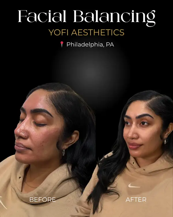 Yofi MedSpa